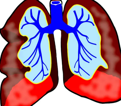 pneumonia previne