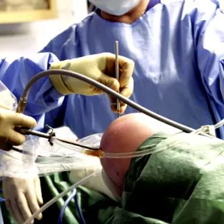 osteoartrita îngrijire