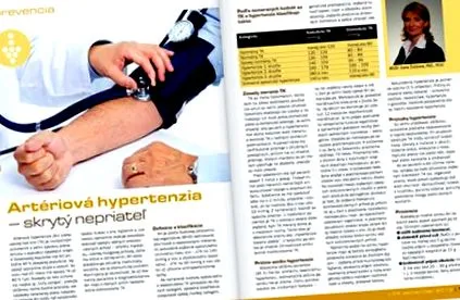 ascuns arterială
