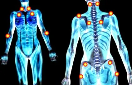 Disponibil internet fibromialgie