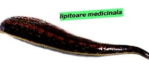 hijama