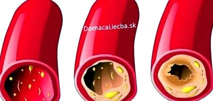 alimente vasele