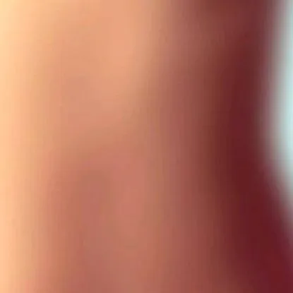 reduc