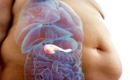 diabetul dacă pacienții