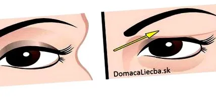 vindecă rezultatele
