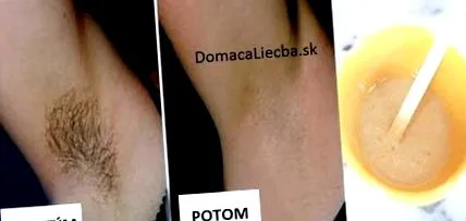 мишниците