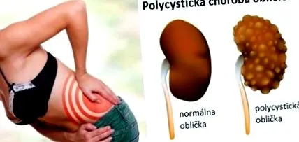sunt simptomele