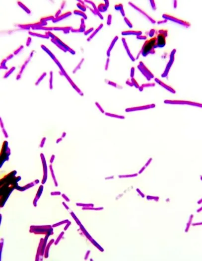 ochi test