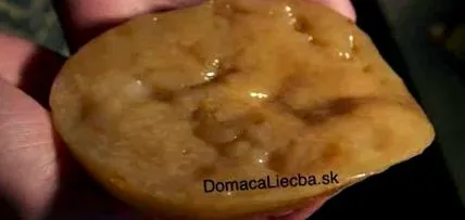 kombucha
