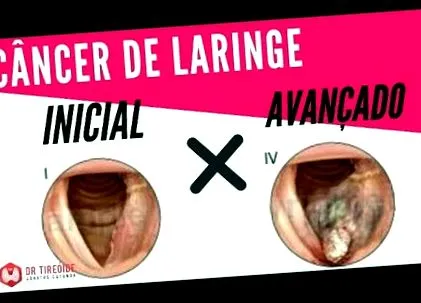 dolor garganta