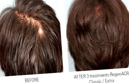 medermis dermatologie