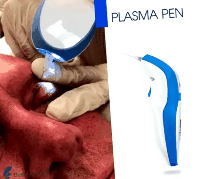 pleoapelor