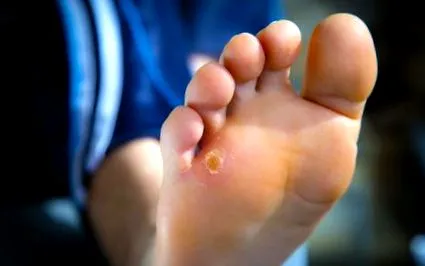 este