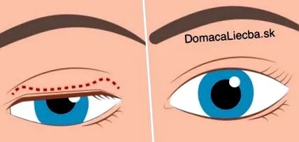îndepărtați