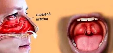 pentru pentru