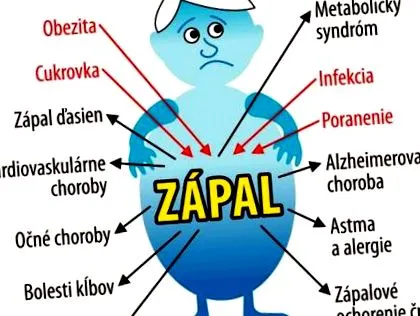 antiinflamatoare
