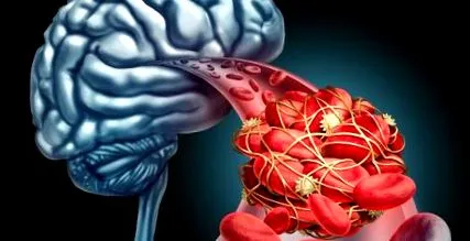 cerebral prevenirea