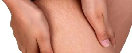 ricinusolaj ricinusolaj
