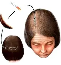 чекати