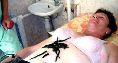 piócákkal
