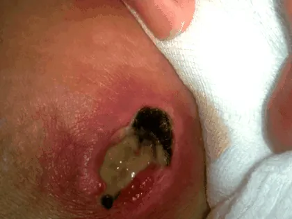 nepoata