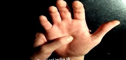 miraculoasă