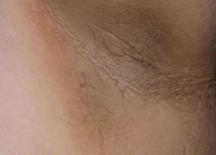 piele întunecate