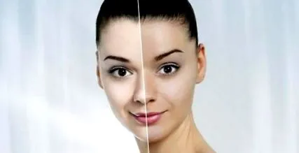 albiți natural