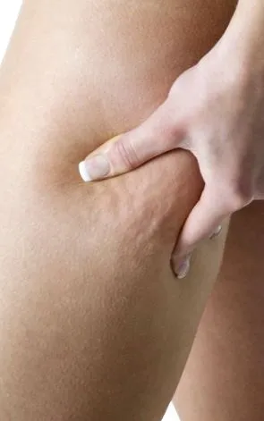 celulitei