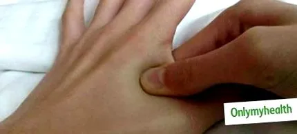 puncte durerii