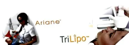 activare dinamică
