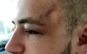 Acest lucru brutalitate