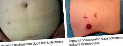 црево
