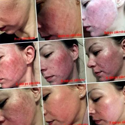 dermatologul petele