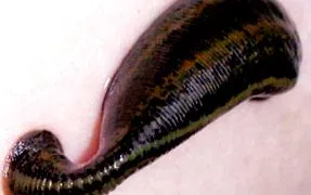 rege hirudoterapie