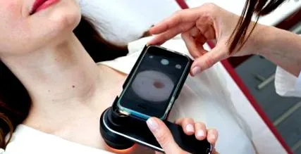 melanomul