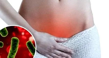 vaginosis