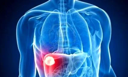 paraziták