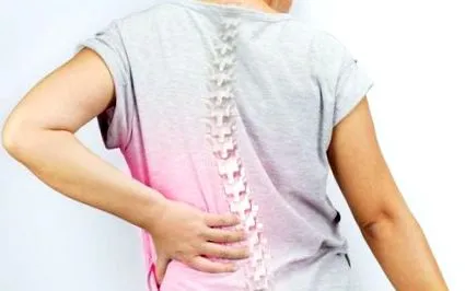 osteoporoza osteoporoza