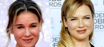 dintr-o zellweger
