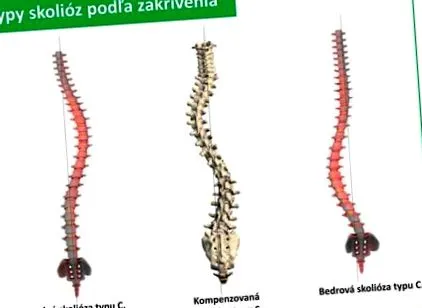 vertebrale