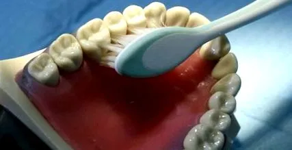 dentară greu
