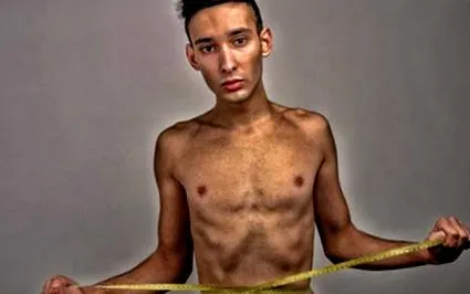 anorexia acest lucru