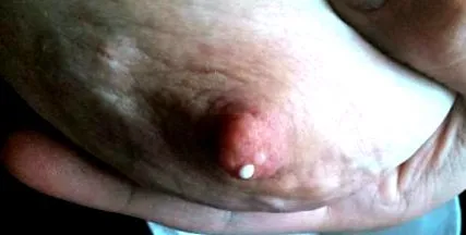 matern