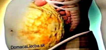 accelera