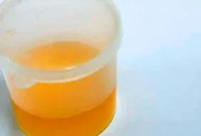 сечі лікування