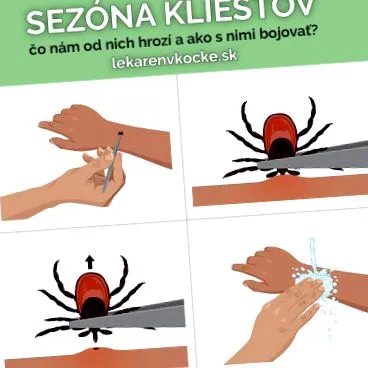 zile după