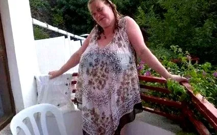 obese obese
