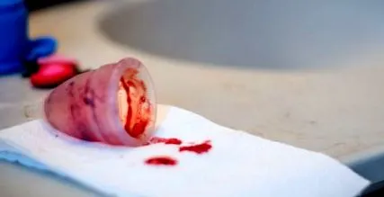 sângelui menstrual