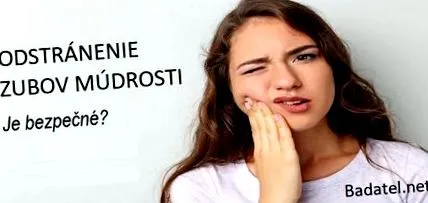 păstrați este